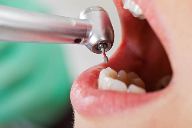 Best Emergency Broken Tooth Repair in Stewart Manor, NY